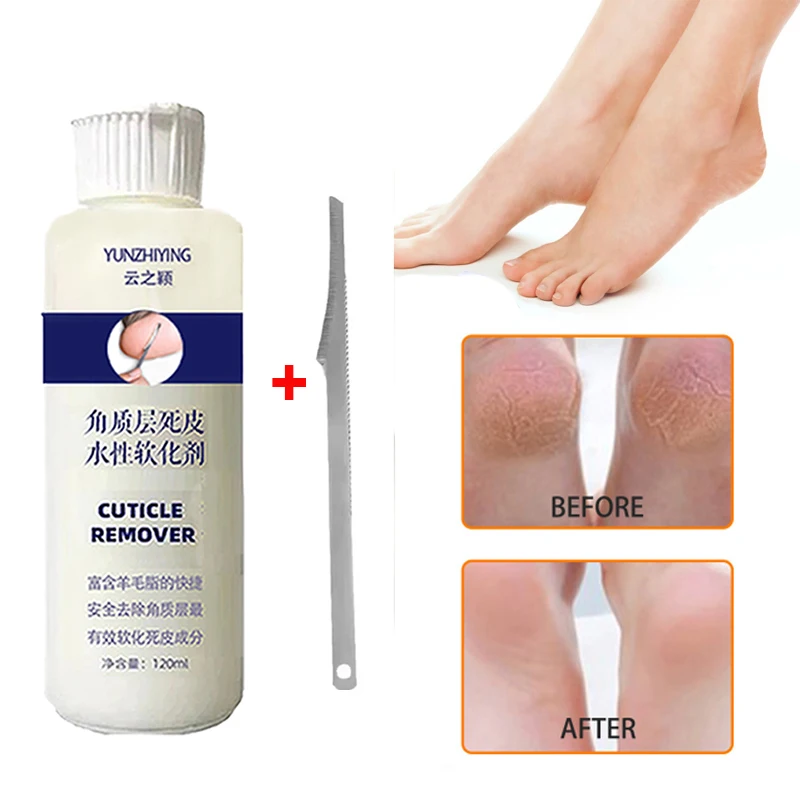 Esfoliador de pés para pele morta e calos, Enhancer de calcanhar antirrachado, Máscara amaciante de 7 segundos, Kit Pedicure, 120ml