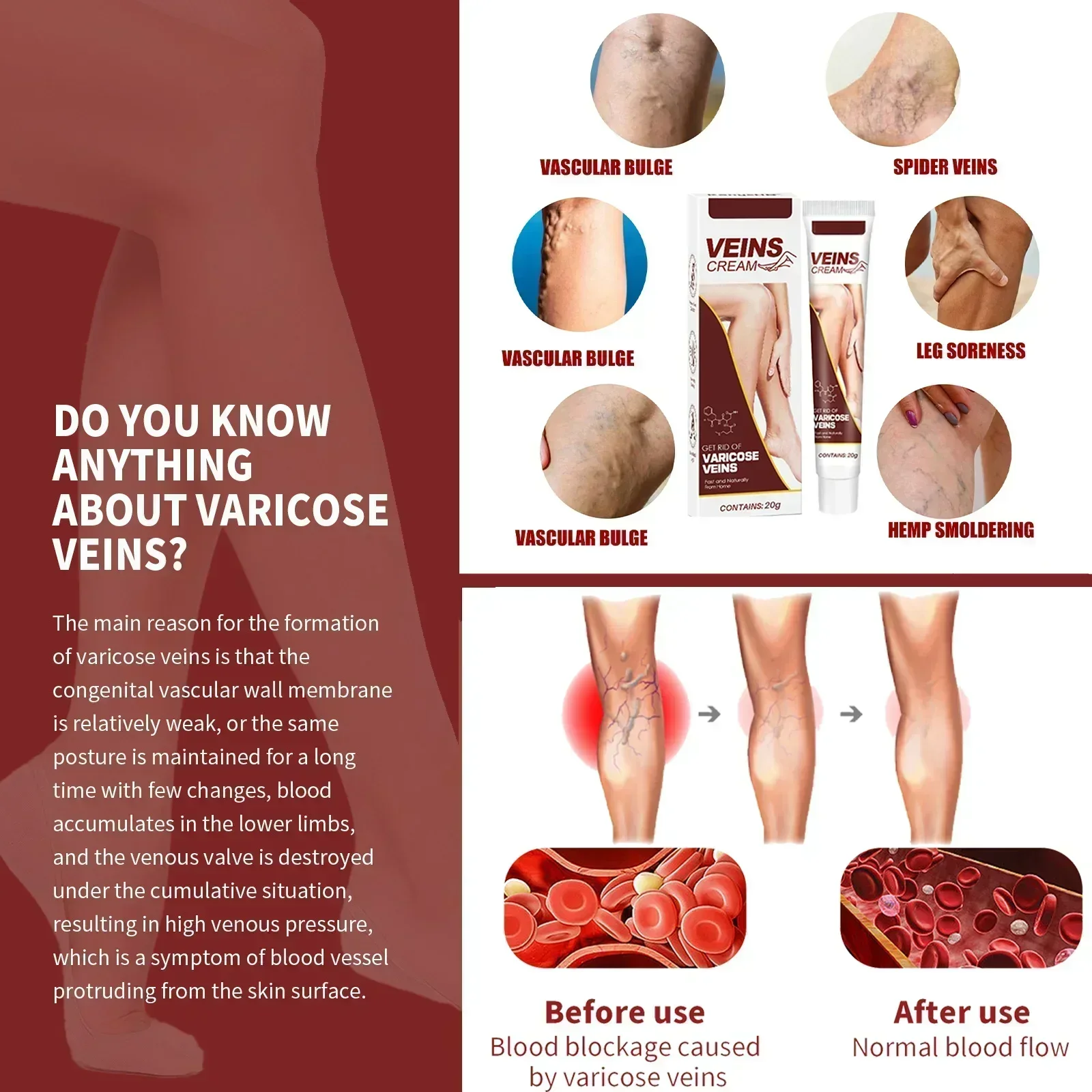 Safe and effective varicose vein removal Effective treatment of vasculitis Fast treatment of leg varicose vein removal  Fast