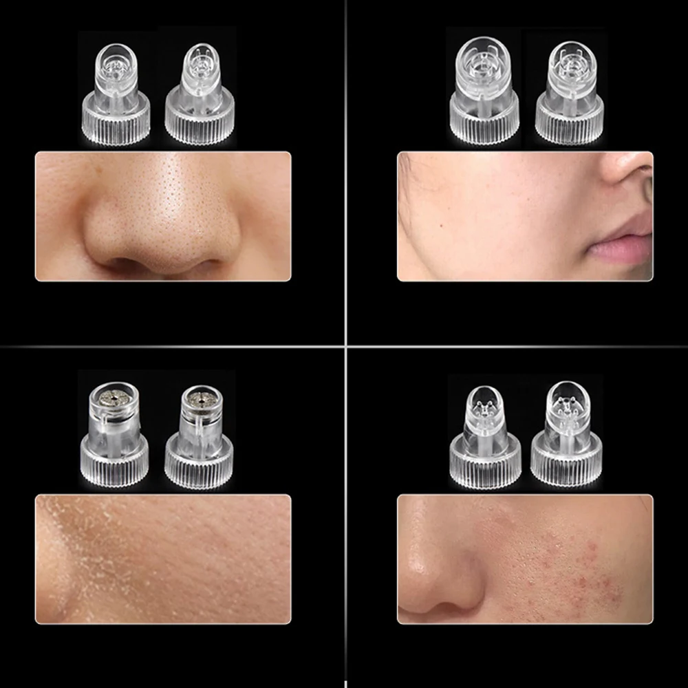 9pcs Tip for Hydro Facial Skin Care Tool Dermabrasion for H2O2 Water Oxygen Jet Peel Hydrafacial Microdermabrasion Accessories