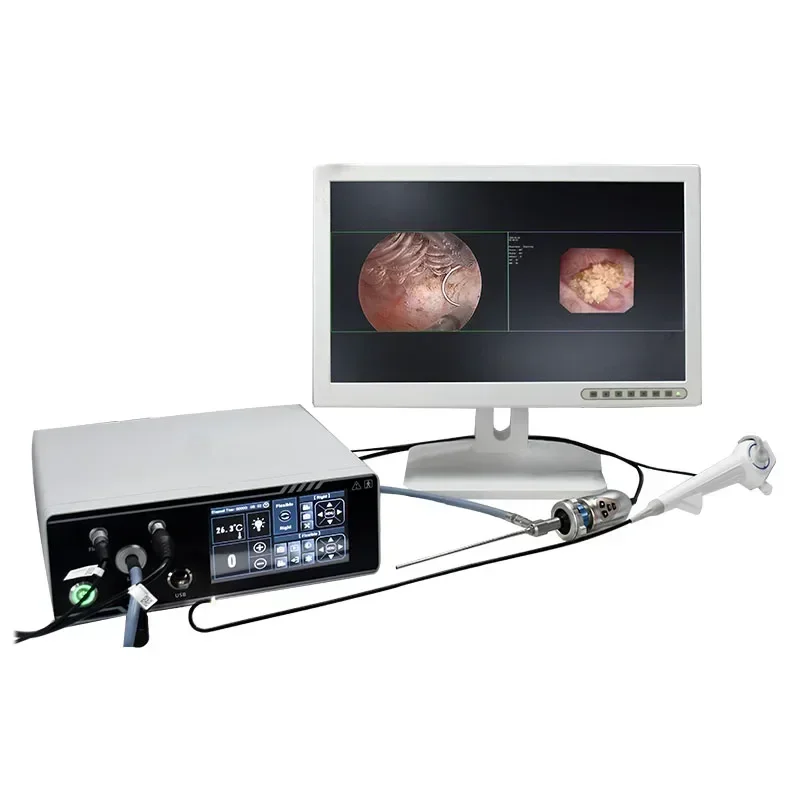 New High Quality Hospital Surgery Medical 2 in 1 Integrated Rigid Endoscopy and Flexible Endoscopic System
