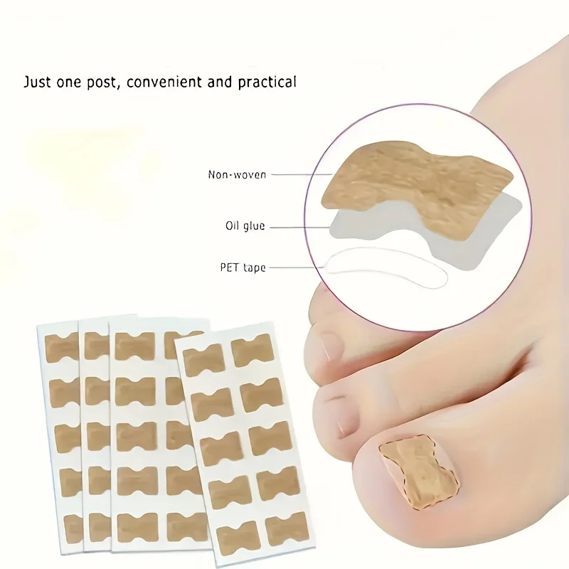 100 comfortable ingrown nail correction stickers, easy-to-apply, adhesive-free nail stickers, pain-free relief and nail protecto