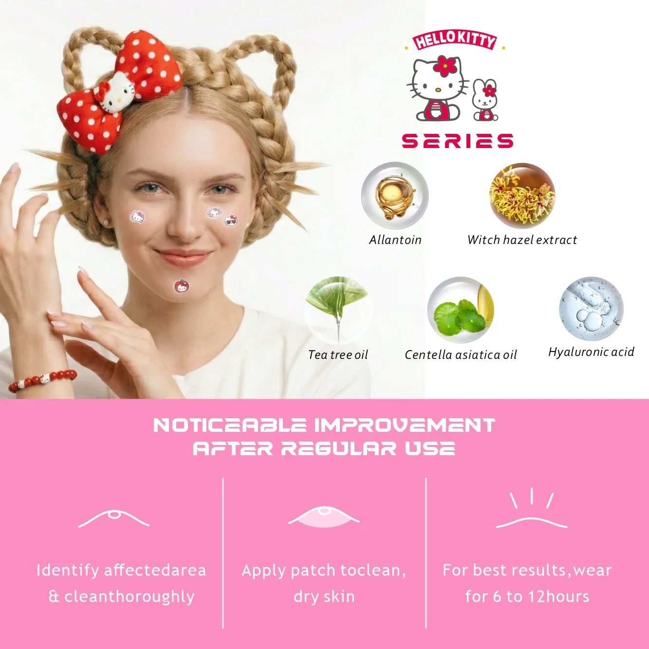 Acne patches, acne stickers, facial acne patches, concealer, concealer stickers 100PCS hello kitty