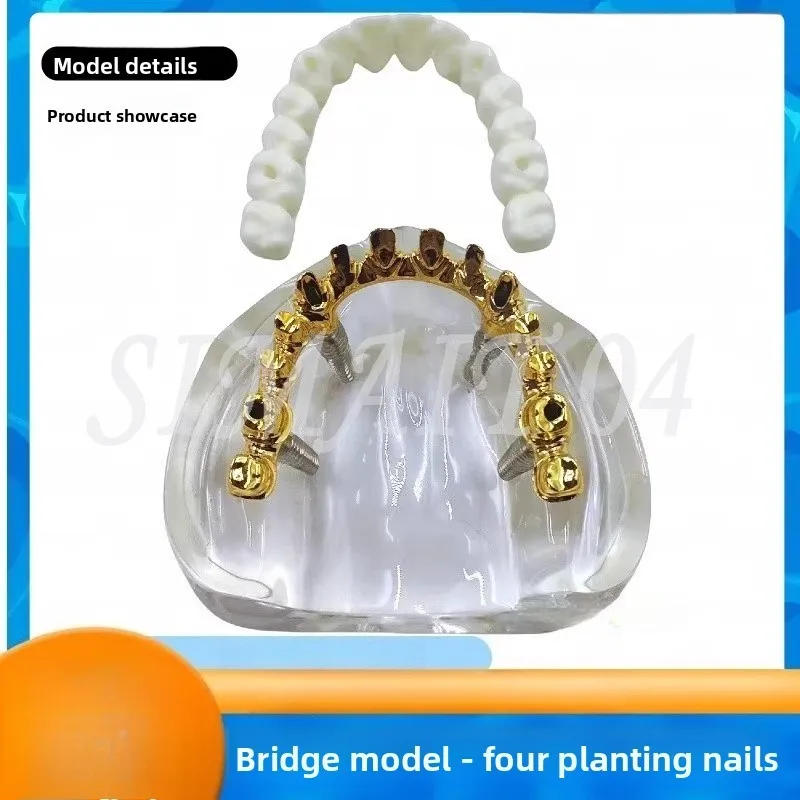 

Dental Oral Model, Bridge Restoration, Dental Implant, Simulation Demonstration, Simulation Teaching