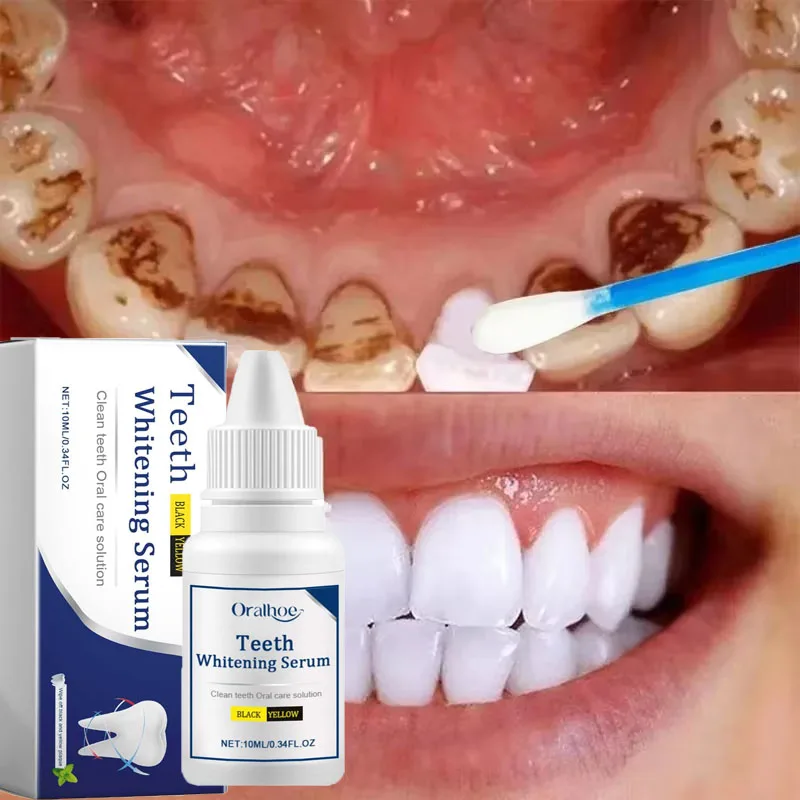 Teeth Whitening Serum Remove Plaque Stains Toothpaste Deep Cleaning Dental Oral Hygiene Tools Fresh Breath Tooth Care Products