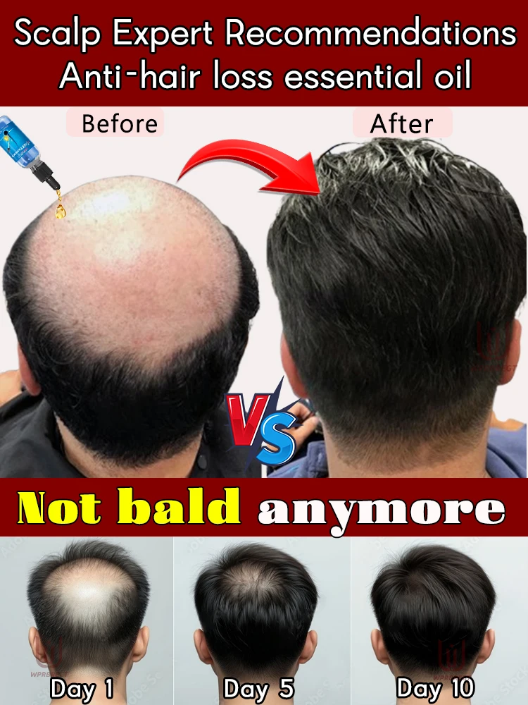 

Accelerate hair root growth, no longer worry about baldness, men's fast hair growth agent, best-selling hair oil in the world