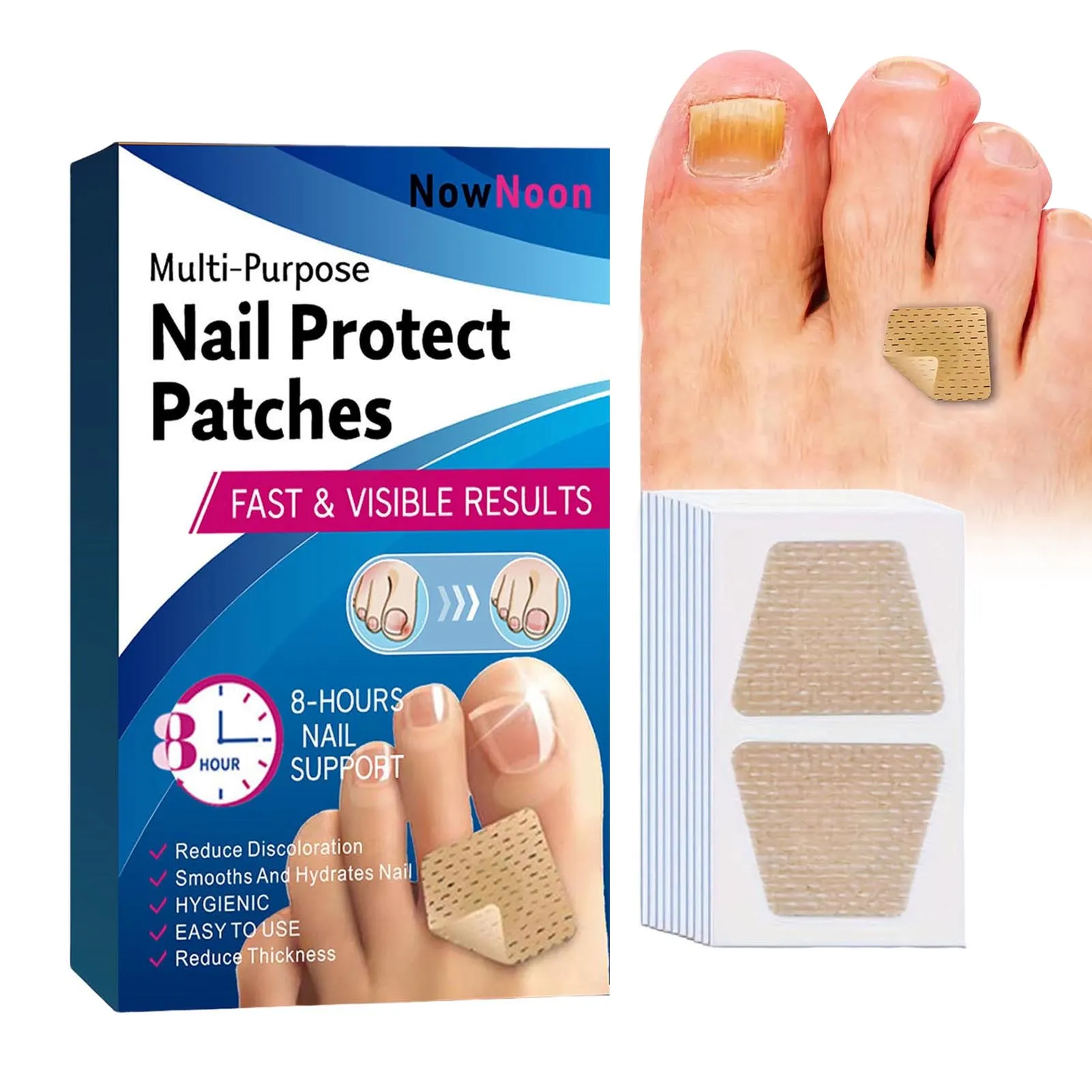 Ingrown Paronychia Toenail Corrector Patches, Etiqueta auto-adesiva, Conjunto de ferramentas para Ingrown Toe Nail Treatment, 72Pcs