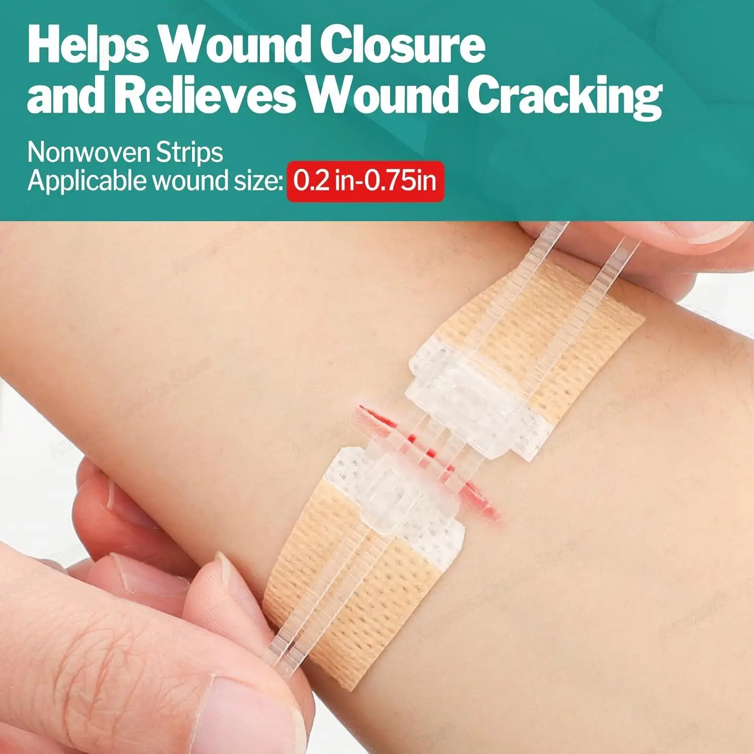 Sanke Rescue 14/28 Pack Wundverschlussstreifen Reißverschluss-Verband Notfall-Wundverschluss-Set Wundreparatur-Verschlussvorrichtung – Detail 6