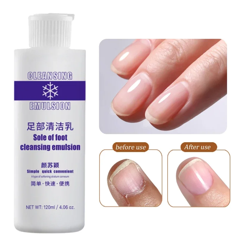 Juego de cuidado de los pies, 120ml, exfoliante para pies, suavizante, 7 segundos, elimina callos de piel muerta, mascarilla para pies, potenciador del talón antigrietas, cuidado de las uñas