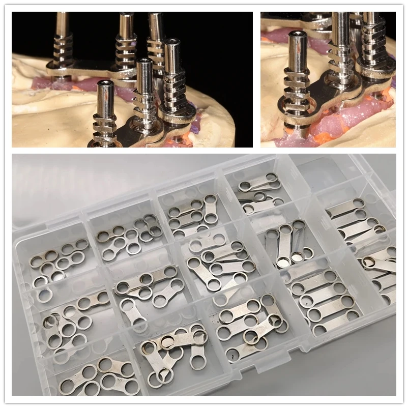 

70Pcs All on 4 Dental Prosthesis Metal Implant Supported Overdenture Bar High Quality Stainless Steel All on Four
