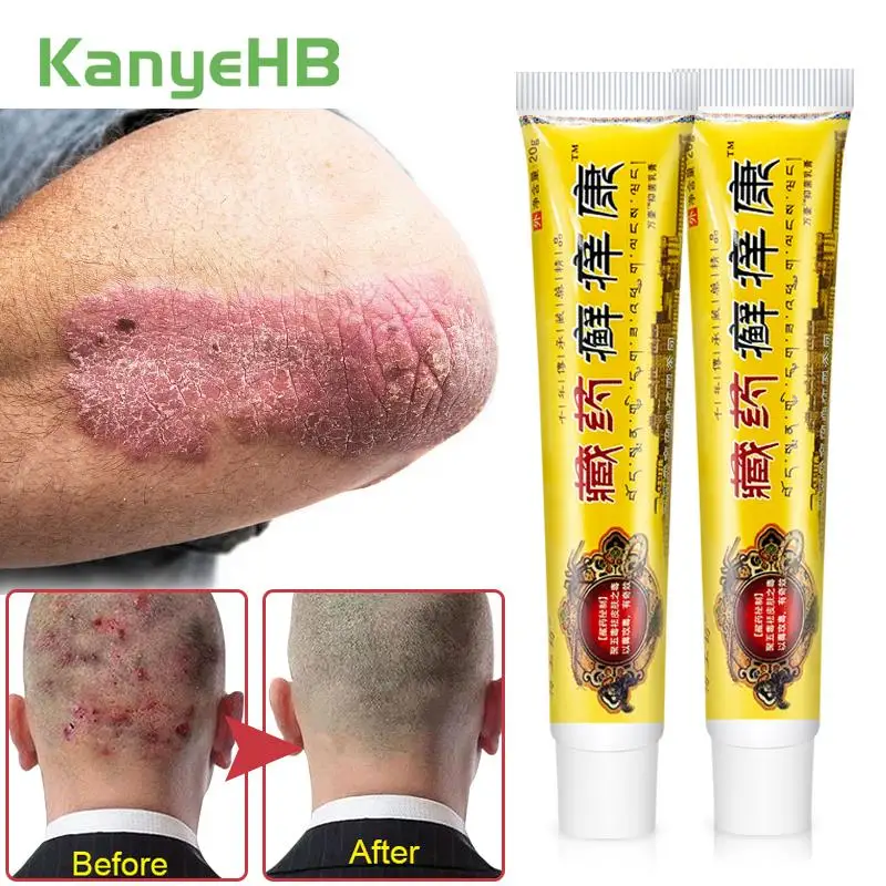 

2Pcs Psoriasis Ointment Dermatitis Eczema Repair Care Cream Treat Eczematoid Skin Dressing Antibacterial Antipruritic Cream A947