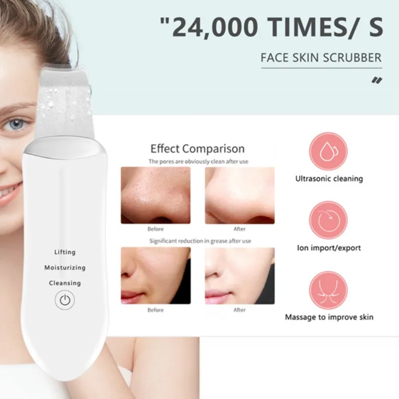 Consegna in 24 ore Scrubber ad ultrasuoni per la pelle del viso Macchina per la bellezza Pulizia profonda del viso Peeling Pala Esfoliante Cura della pelle Devi