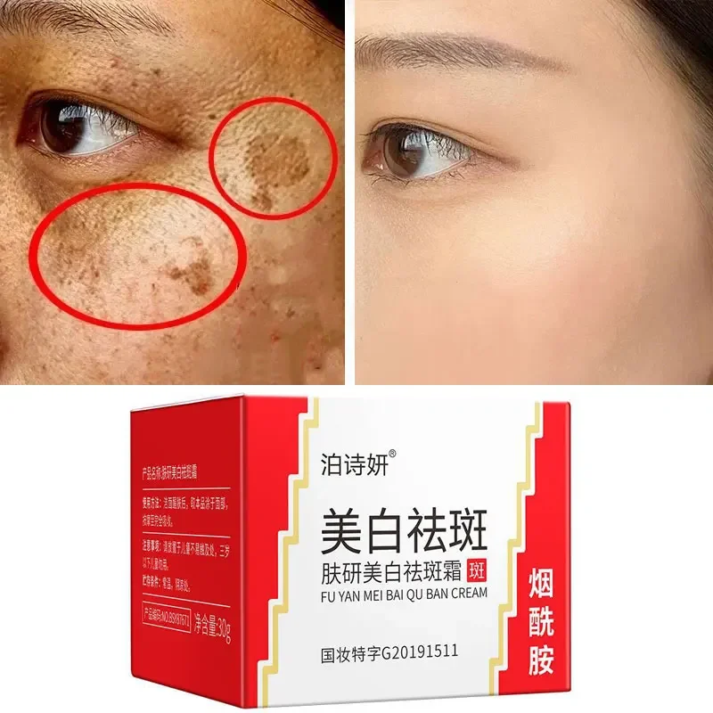 

Effective Whitening Freckle Cream Remove Melasma Acne Spot Pigment Melanin Dark Spots Pigmentation Moisturizing Gel Skin Care