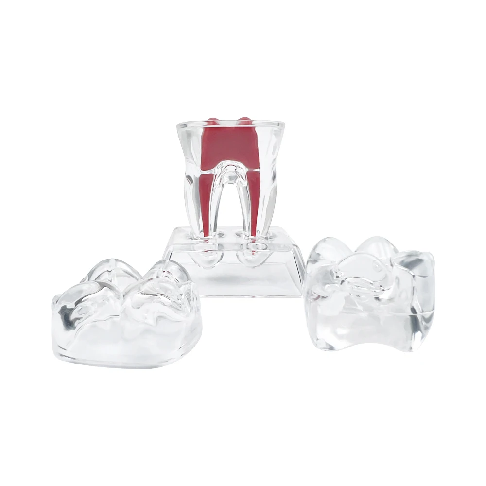 Teeth Model Dental Anatomical Structure Detachable Dental Anatomical Model Transparent Tooth Disintegration Model Dental Anatomy