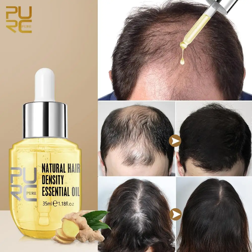 

PURC Products Men Women Ginger Fast Regrowth Oil Anti Hair Loss Scalp Treatment Serum Thicken Grow Hair Care Oil