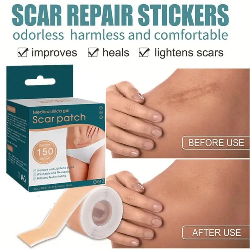 1 Roll Silicone Gel Scar Sheets Skin Repair Patch Removal Self-Adhesive Stretch Mark Tape Scar Skin Care Therapy Patch Burn
