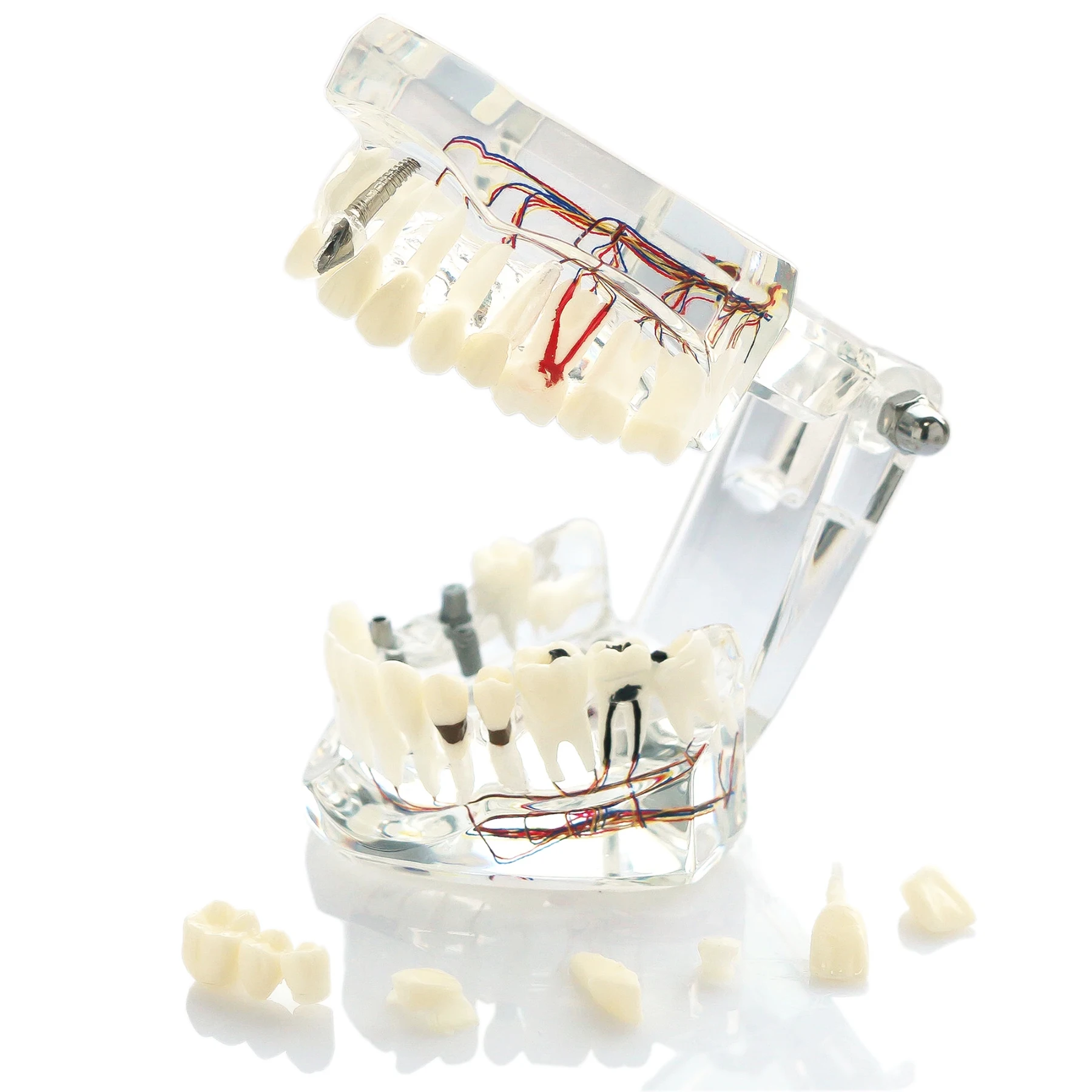 

Dental Oral Typodont Model Implant Pathological Removable Teach Visible Anatomy and Restoration Model