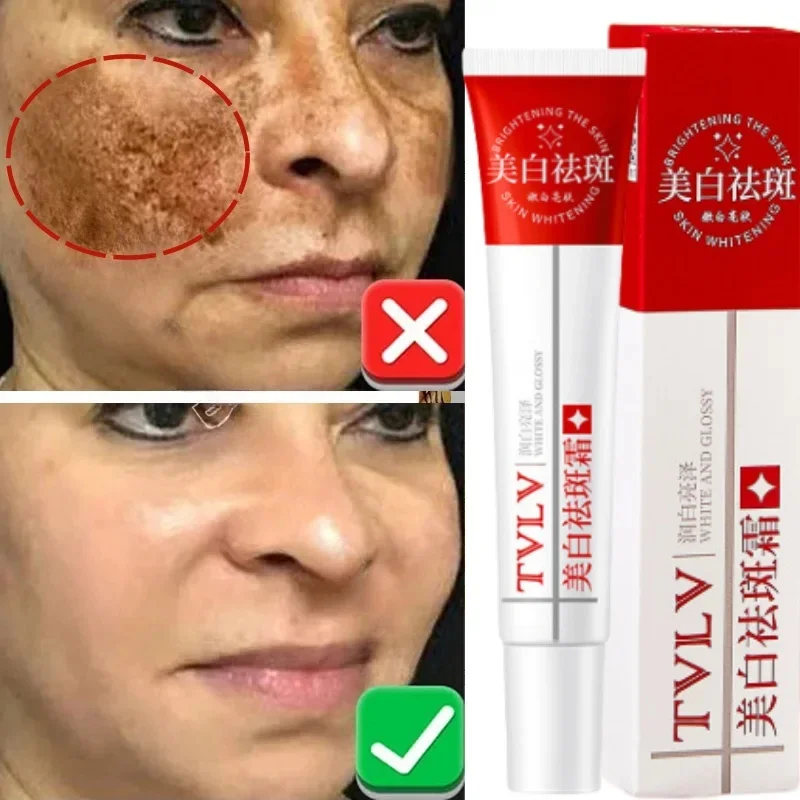 Whitening Freckle Cream Melasma Dark Spots Pigmentation Removal Products Fade Stain Melanin Repair Brighten Korean Skin Care