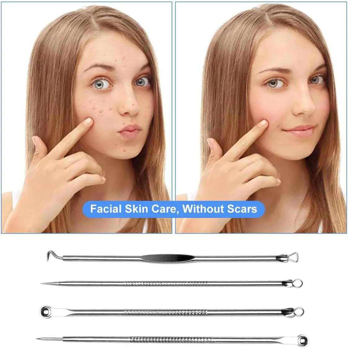 Acne Naald Verwijder Mee-eter Comedo Extractor Gereedschap Roestvrij Staal Gezichtsverzorging Tool Puistje Smet Removal Tools