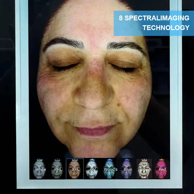 Portable 3d Ai Face Skin Diagnostics Analyzer Facial Tester Scanner Magic Face Mirror Device Skin Analysis Machine Skin Analyzer