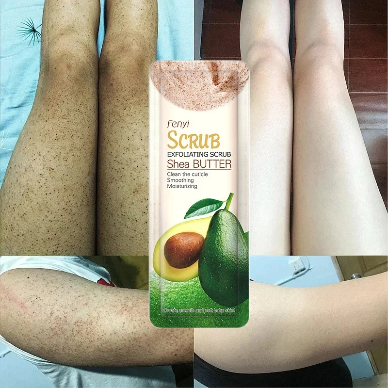 Removal Chicken Skin Scrub Cream Curing Keratosis Pilaris Repair Cream Body Dark Spots Removal Brighten Moisturizing Body Care