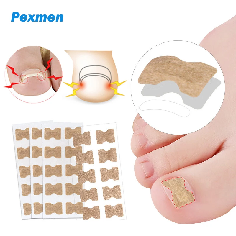 

Pexmen 10/20/50/100Pcs Ingrown Toenail Correction Stickers Toenail Corrector Patch Big Toe Nail Corrector Patch for Women Men