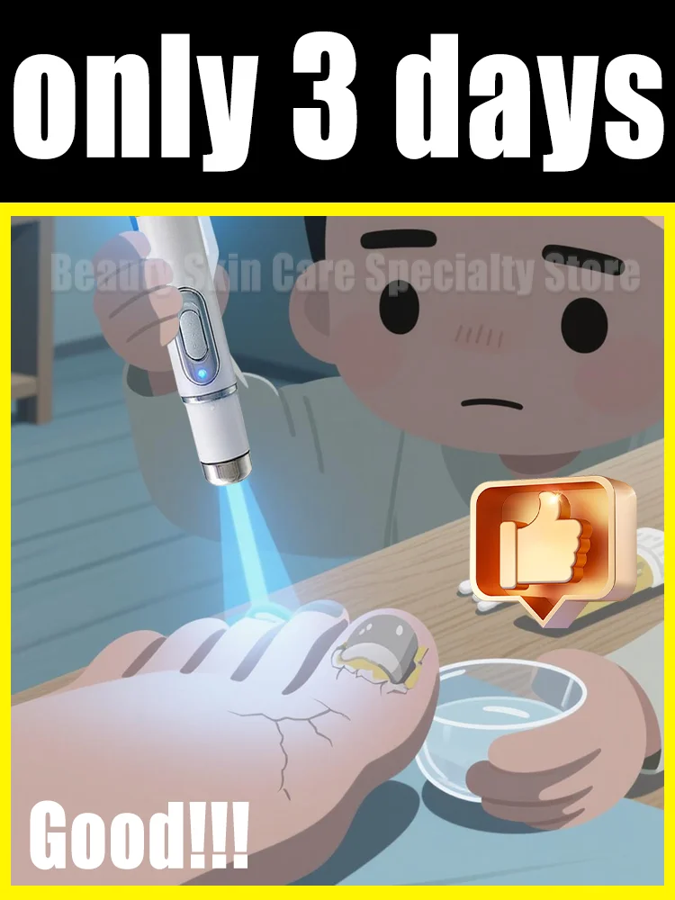 المنتجات الأكثر مبيعًا في عام 2025: التعرف على المتجر الرئيسي الرسمي للمنتجات الأصلية؛ أدوات تنظيف الأظافر، ليزر الضوء الأزرق #1