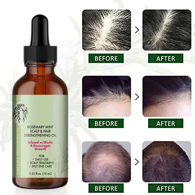 Aceite esencial para el crecimiento del cabello, aceite de menta de Romero para fortalecer el cabello, tratamiento nutritivo para puntas abiertas y cabello orgánico Mielle seco