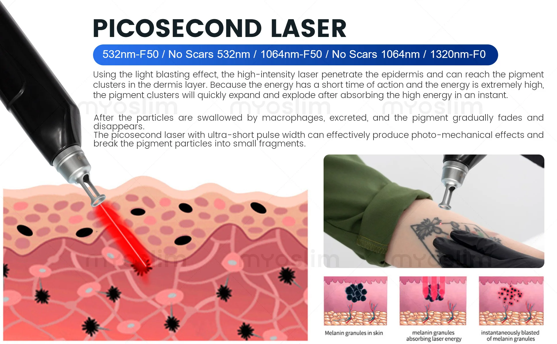 Diode Hair Removal 4 Wavelengths Pico Tattoo Removal Machine 755nm FAC Collimation Ice Cooling System Foldable Touch