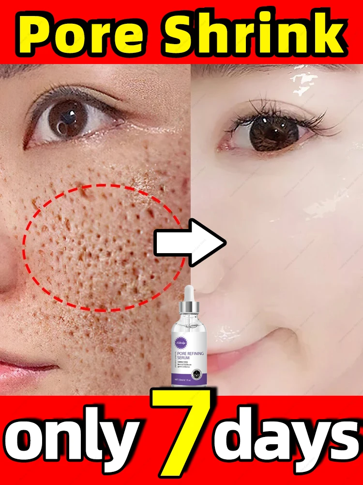 

Solve big pores problem