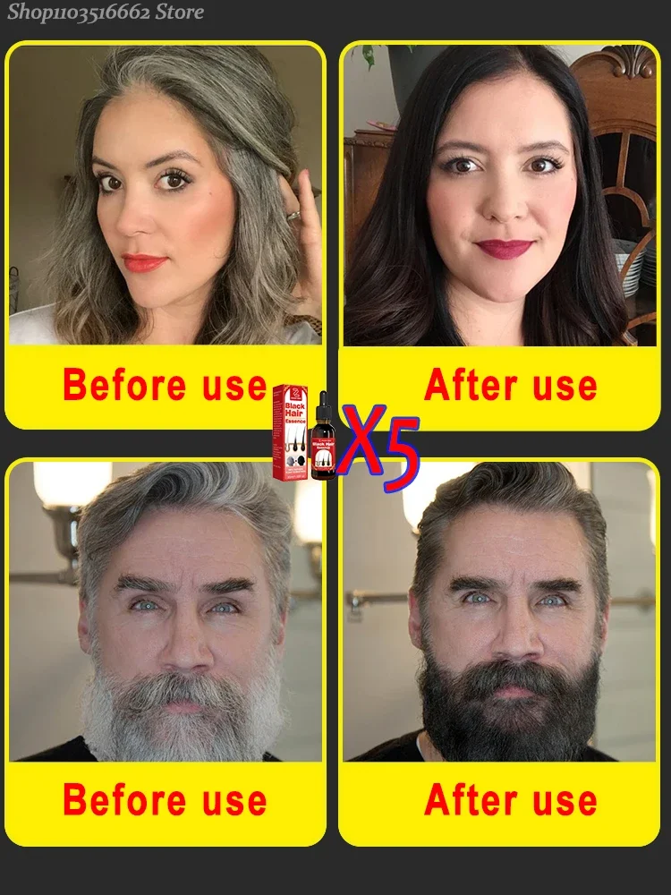 100% Effective Gray Hair Restoration Natural Hair Color Gender: Unisex Hair Style