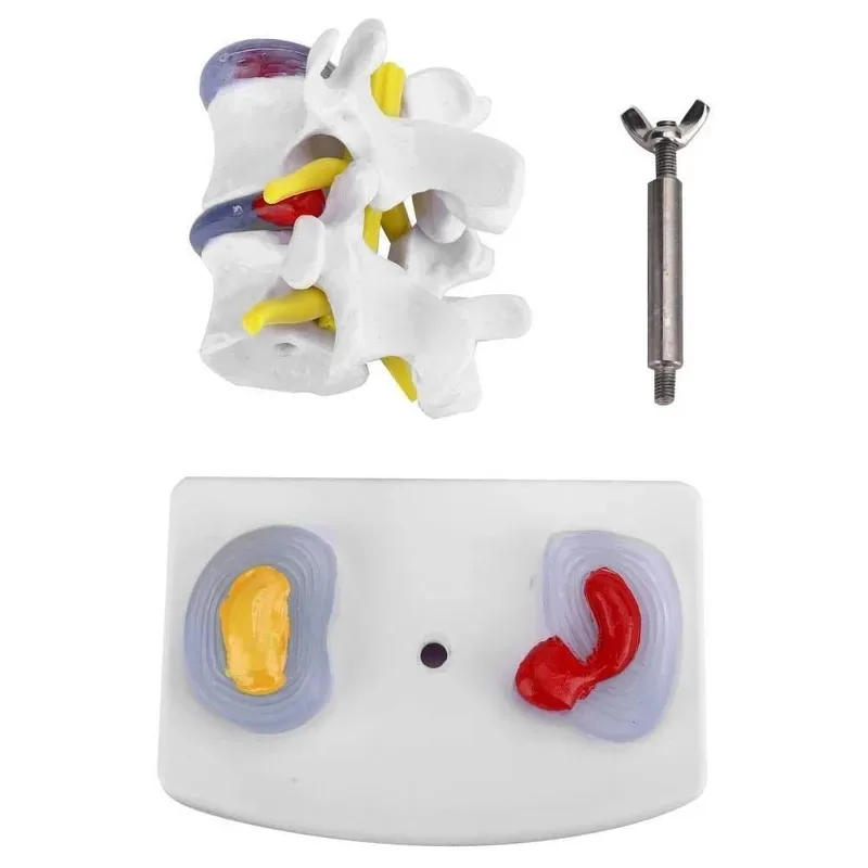 1:1 Lebensgroße anatomische menschliche Bandscheibenvorfall Demonstration Wirbelsäulenanatomiemodell Schultrainingszubehör