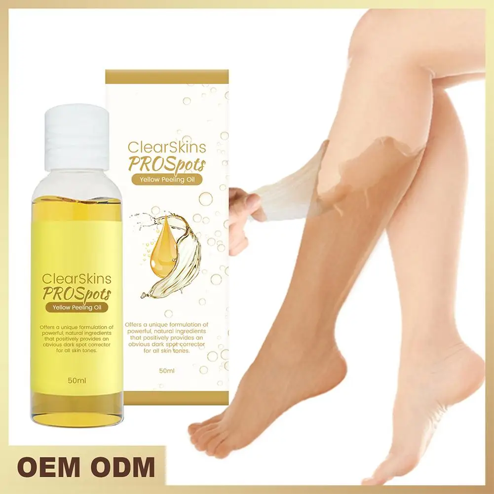 Óleo de Peeling Amarelo para Pele Negra, Esfoliante, Branqueamento, Remover, Joelho, Cuidado de Branqueamento, Pele Morta, Corpo, Manchas, X8C2