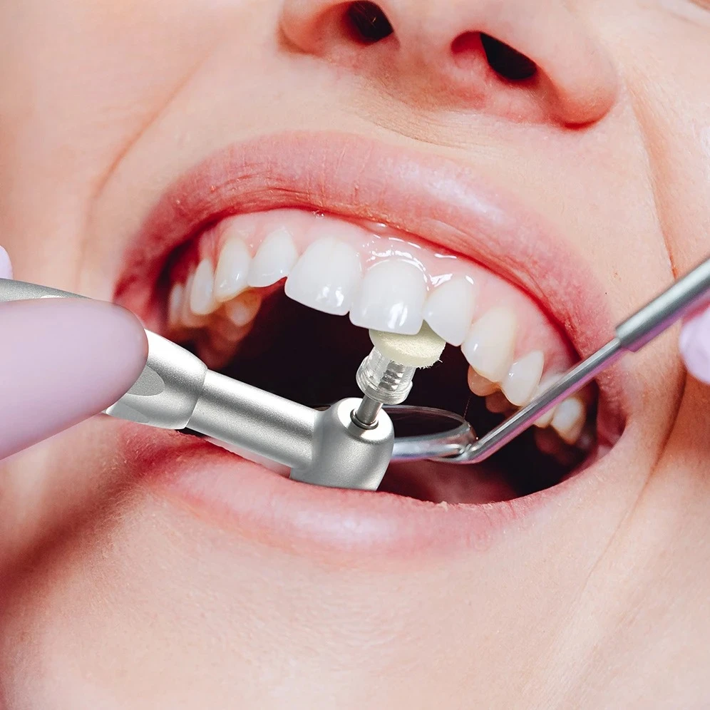 50 قطعة/صندوق AZDENT قرص تلميع مركب للأسنان معجون تلميع عجلة لباد يمكن التخلص منها عالي اللمعان CA مغزل #2