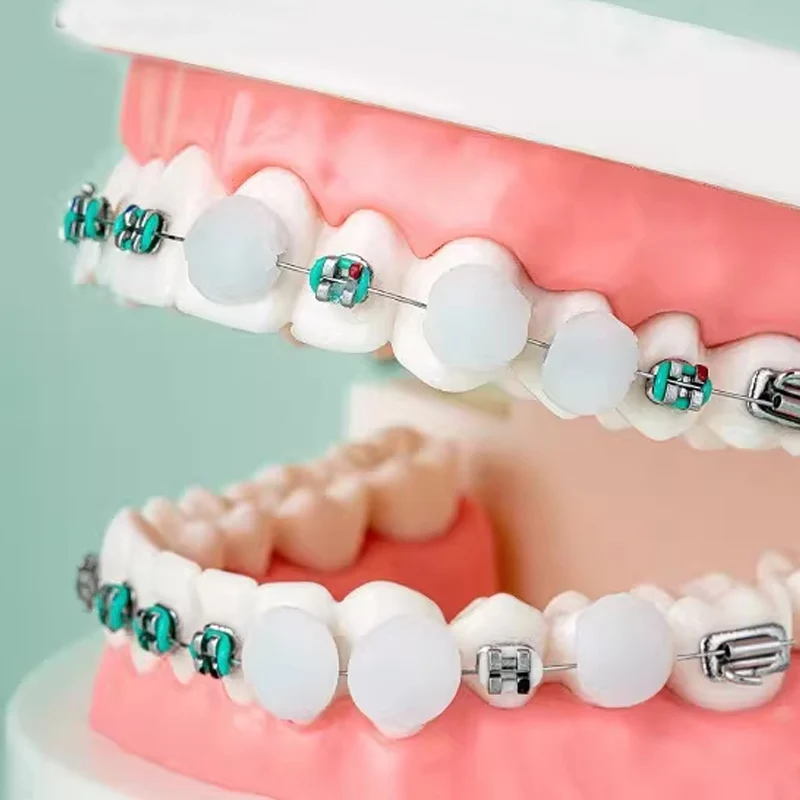 Thumbnail 4 - #32 Trending Dental Mouthguards Right Now