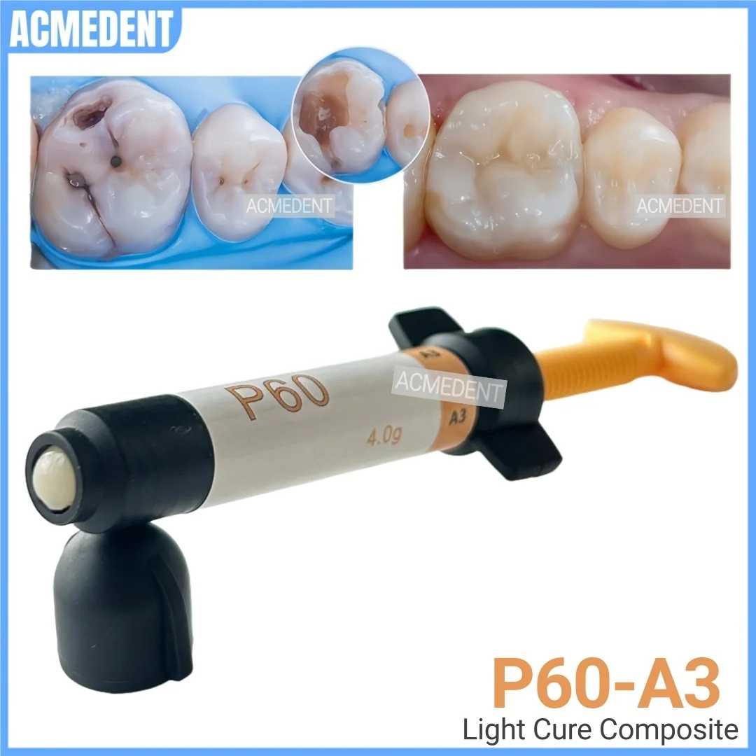 

4g Dental P60 A3 светоотверждаемая композитная смола, универсальный шпон, отбеливающий материал для наполнения зубов, инструмент для восстановления задних зубов