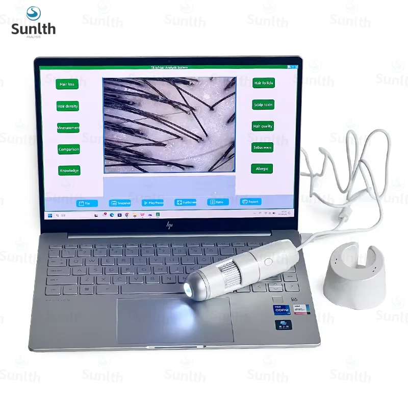 

Professional Digital Microscope Electron Dermatoscope Scalp Detection Pores Magnifier Facial Skin Analyzer Machine Computer Use