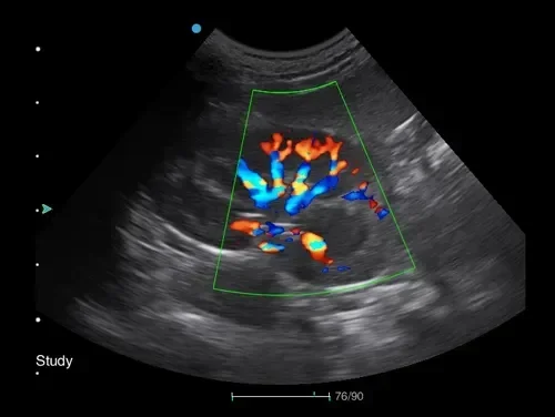 SYA-Apogee 2300 Echo Hospital 4d echocardiography