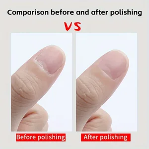 LINMANDA Brocas para unhas Gel Brocas para lixas de unhas Removedor de cutícula Brocas para unhas com estojo Acessórios para brocas para unhas Suprimentos para arte em unhas 8 principais vendas removedor de cuticula - №4