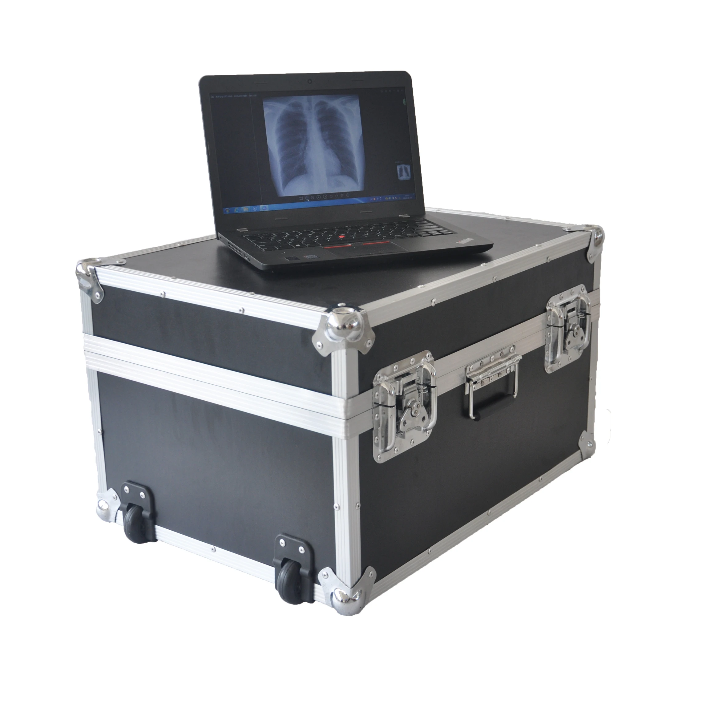 2026 New 8KW Portable X-ray System With Electric Power Class II Digital