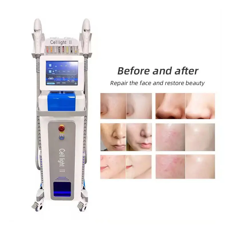 

New Arrival 2 In 1 IPL Acne Removal DPL OPT Elight Skin Rejuvenation Machine with 11 filters double handles