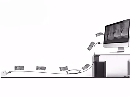 Billigerer Preis intra orales Bildgebung system digitaler zahn ärztlicher RVG-Röntgens ensor