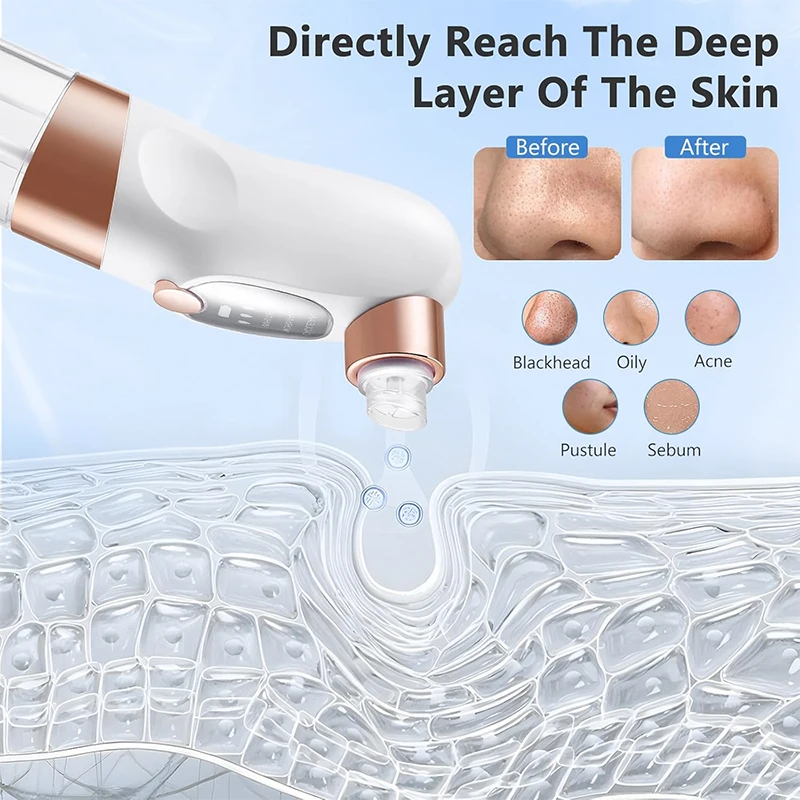 Electric Blackhead Remover Pore Vacuum Face Cleaner Pimple Acne Black Head Removal Water Cycle Black Dot Remove Cleasing Machine