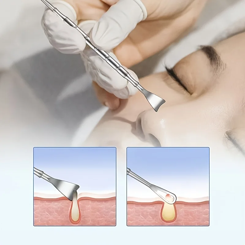 Herramienta de eliminación de espinillas de doble punta de acero inoxidable - Limpiador de vello de nariz hipoalergénico para pieles beige claras, aspecto metálico liso