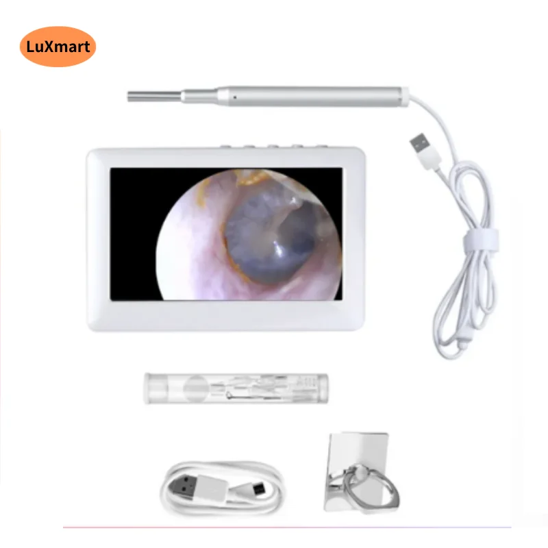 visual ear limpeza endoscopio otoscopio digital alta definicao ear picking tools for homecare 43in 39 mm 01