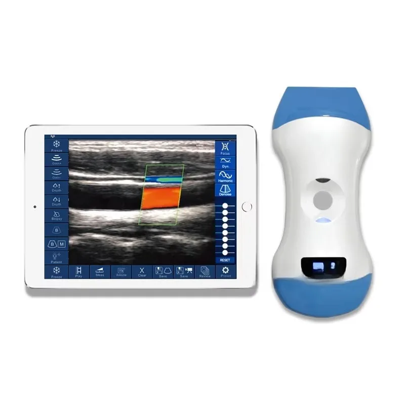 Portable  USG Machine Doppler Micro Convex Usb Wifi Wireless Ultrasound Probe 3 in 1