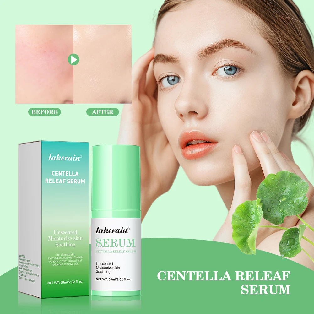 60ml Soothing Calming Face Centella Releaf Serum For All Skin Types Moisturizing Repair Skin Lotion Essence Skin Care Products