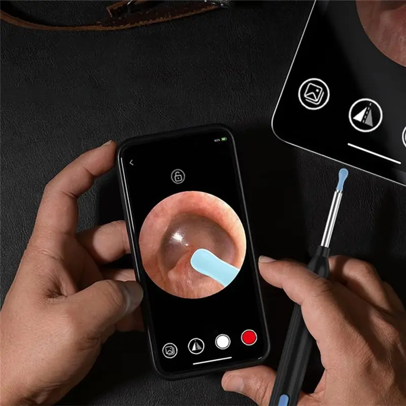 PHILE-Visual Ear Otoscope Endoscope Earwax Removal Tool For Nose Teeth Wireless Earpick Camera Health Care Ear Cleaner