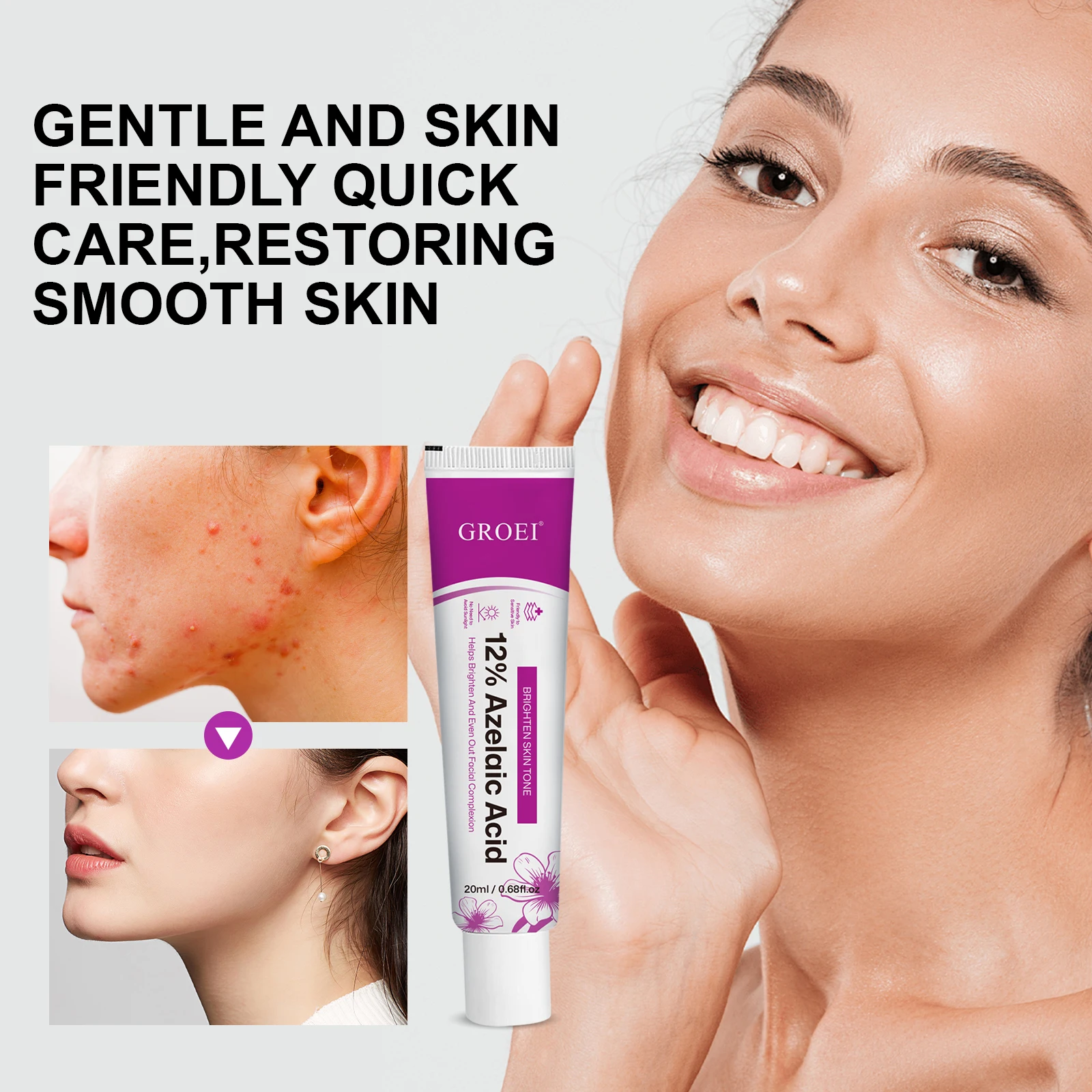 كريم سيروم بحمض الأزيليك 12% ل - مراجعة Azelaic Acid Serum وسعره