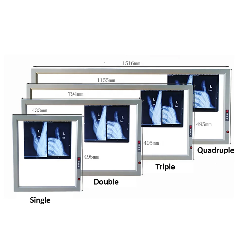 Adjustable Medical LED X Ray Imaging Film Viewer View Box Xray Viewer Panel Led Negatoscope Negatoscope X-ray Viewing Box