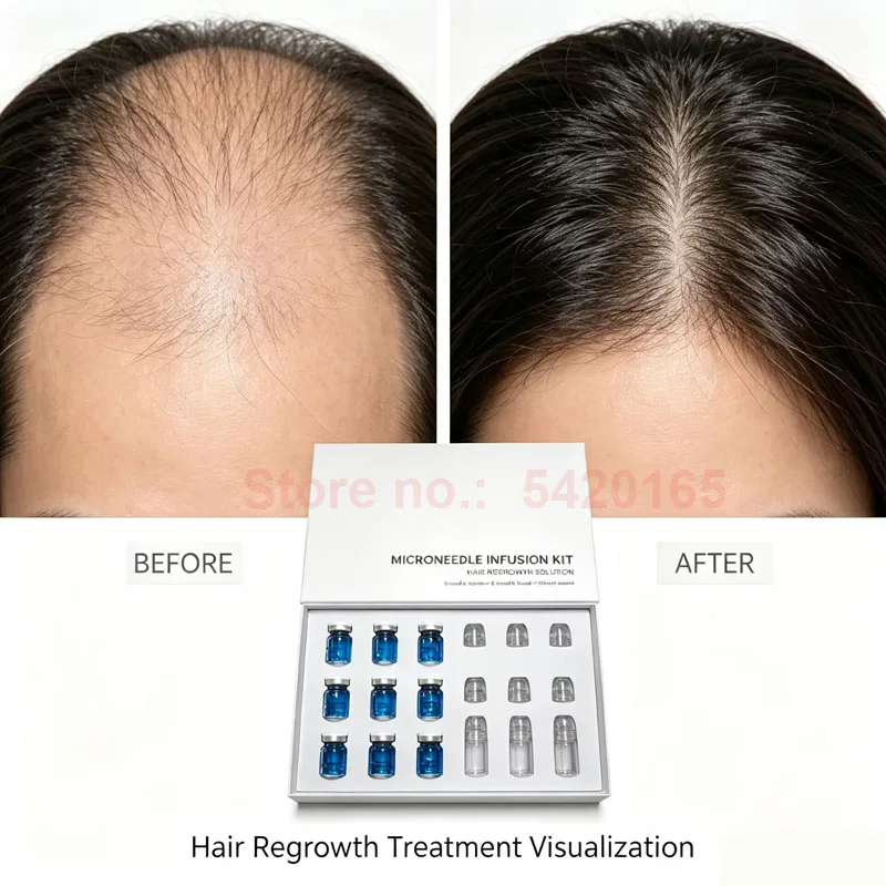 Microneedle GHK-Cu AHK-CU Hair Regrowth Solution Scalp Nourishing Serum For Hair Health Maintenance Needle Head Use Scalp Care